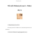 Nốt ruồi (Melanocytic naevi – Moles) (Kỳ 2)