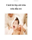 Cách bỏ lớp cứt trâu trên đầu trẻ