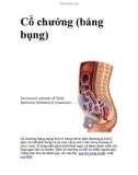 Cổ chướng (báng bụng)