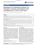 báo cáo khoa học: Radiological and pathological findings of a metastatic composite paraganglioma with neuroblastoma in a man: a case report