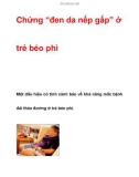 Chứng 'đen da nếp gấp' ở trẻ béo phì