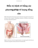 Điều trị bệnh trĩ bằng các phương pháp vi lượng đồng căn