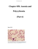 Chapter 058. Anemia and Polycythemia (Part 6)