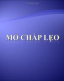 MỔ CHẮP LẸO