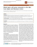 Báo cáo khoa học: Mixed germ cell tumor metastatic to the skin: Case report and literature review