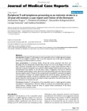 Báo cáo y học: Peripheral T-cell lymphoma presenting as an ischemic stroke in a 23-year-old woman: a case report and review of the literature