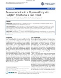 báo cáo khoa học: An osseous lesion in a 10-year-old boy with Hodgkin's lymphoma: a case report