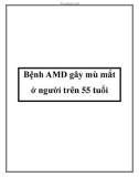 Bệnh AMD gây mù mắt ở người trên 55 tuổi