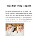 Bí ẩn hiện tượng song sinh