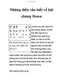 Những điều cần biết về hội chứng Down